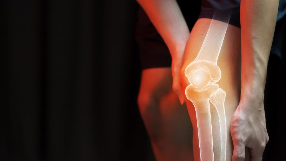 Why Does My Knee Hurt and Do I Need to See a Doctor? A Sports Medicine Doctor Explains